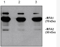 RFA | Baker's yeast replication factor A (100 ĩl) in the group Bacterial/Fungal Antibodies at Agrisera AB (Antibodies for research) (AS07 214-100)